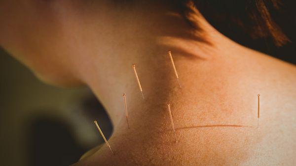 Simone Straub Acupuncture